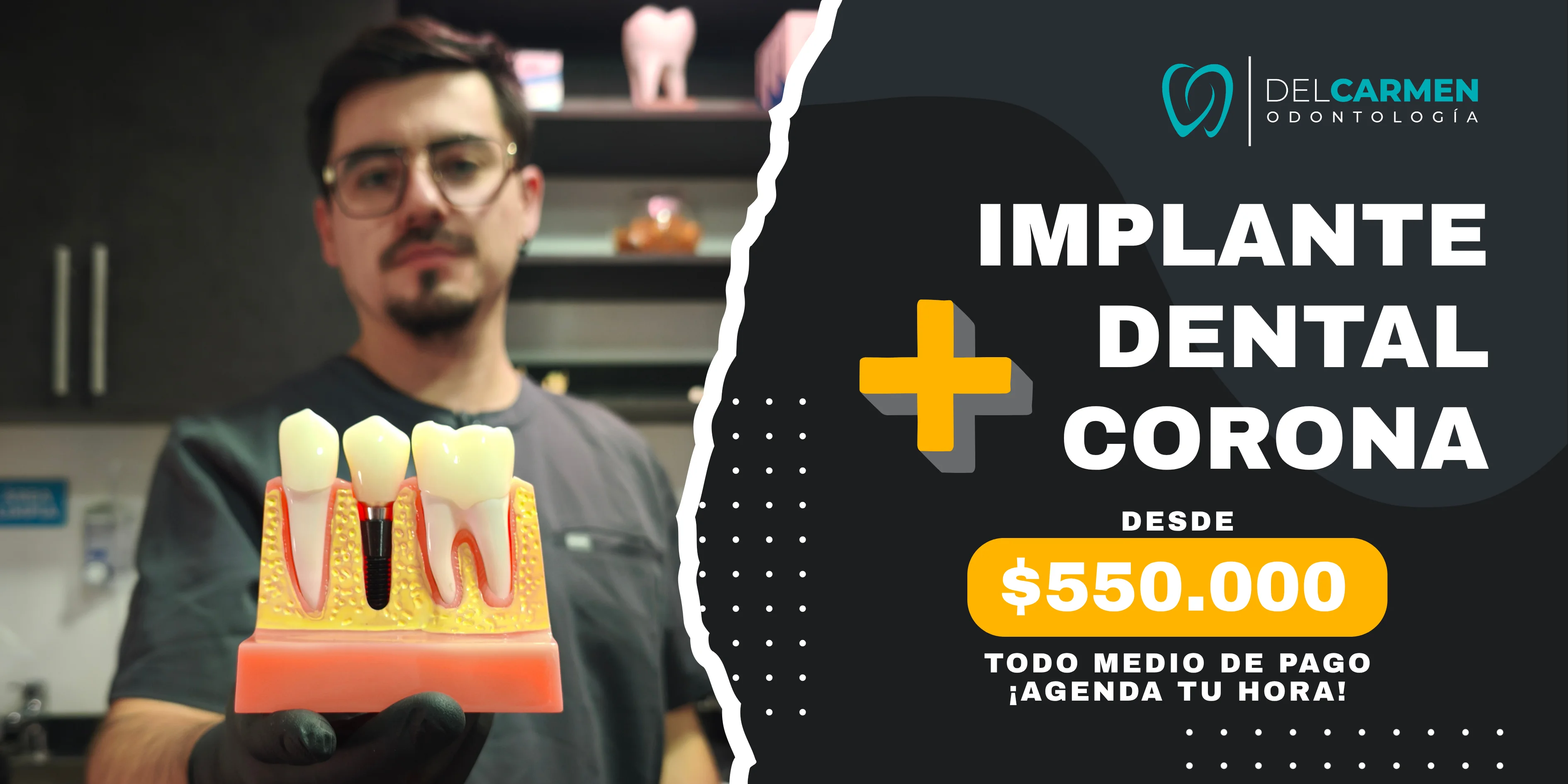 Promoción implante dental