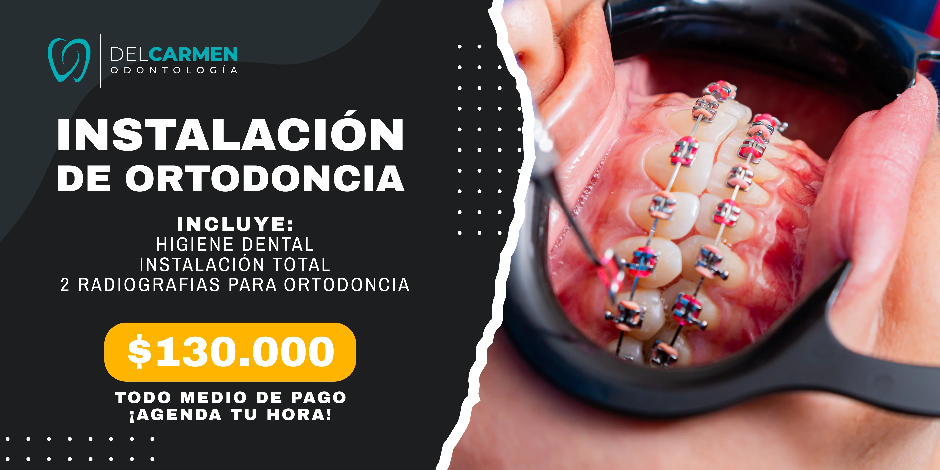 Promoción ortodoncia