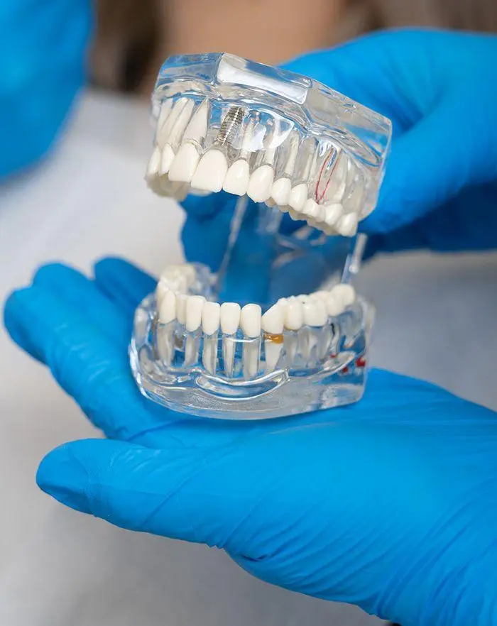 Tratamiento de estética dental en Del Carmen Odontología