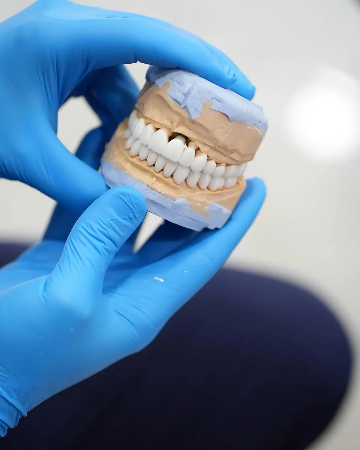 Tratamiento de periodoncia en Del Carmen Odontología